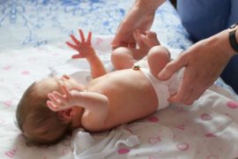 30% dos bebês prematuros nascem com hérnia inguinal